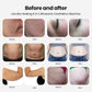 6-in-1 Cavitation & RF Beauty Machine For Saloon And Home