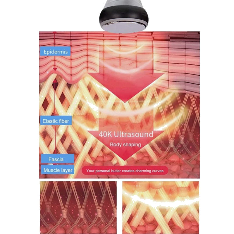 Bio Healing 6-in-1 Ultrasonic Cavitation + RF Machine