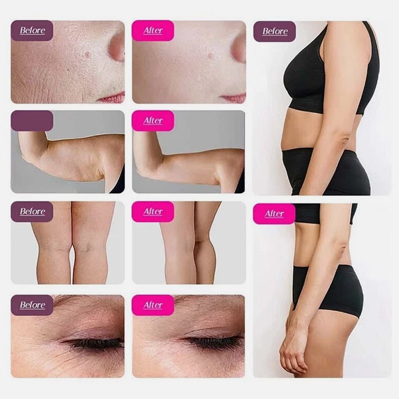 9-in-1 Cavitation & RF Body Contouring Machine For Home And Saloon